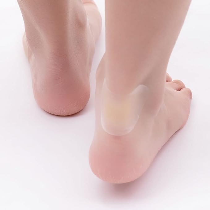 Maliben | Soothestep – Transparent Gel Pads That Instantly Prevent Blisters
