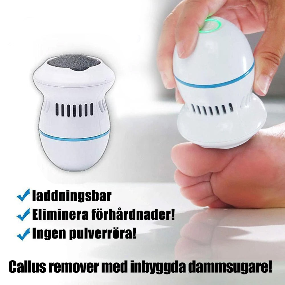 Maliben SoleSmooth Electric Callus Remover — Smooth Feet Fast