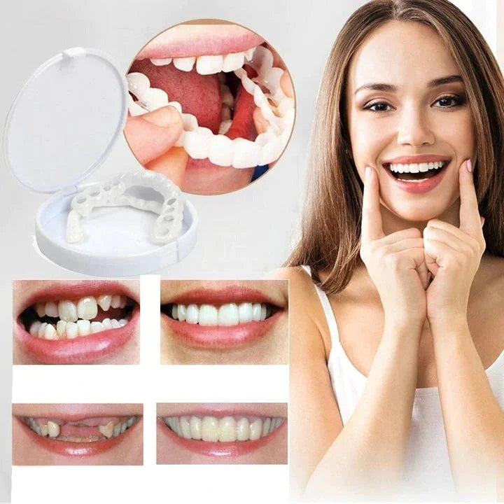 Maliben | Instant Smile TransformatiOn With Snap on Smile Veneers
