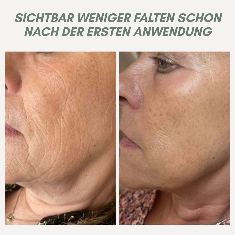 Maliben | Youthmorph — Tight SkIn in Minutes For Your Youthful Wow Moment