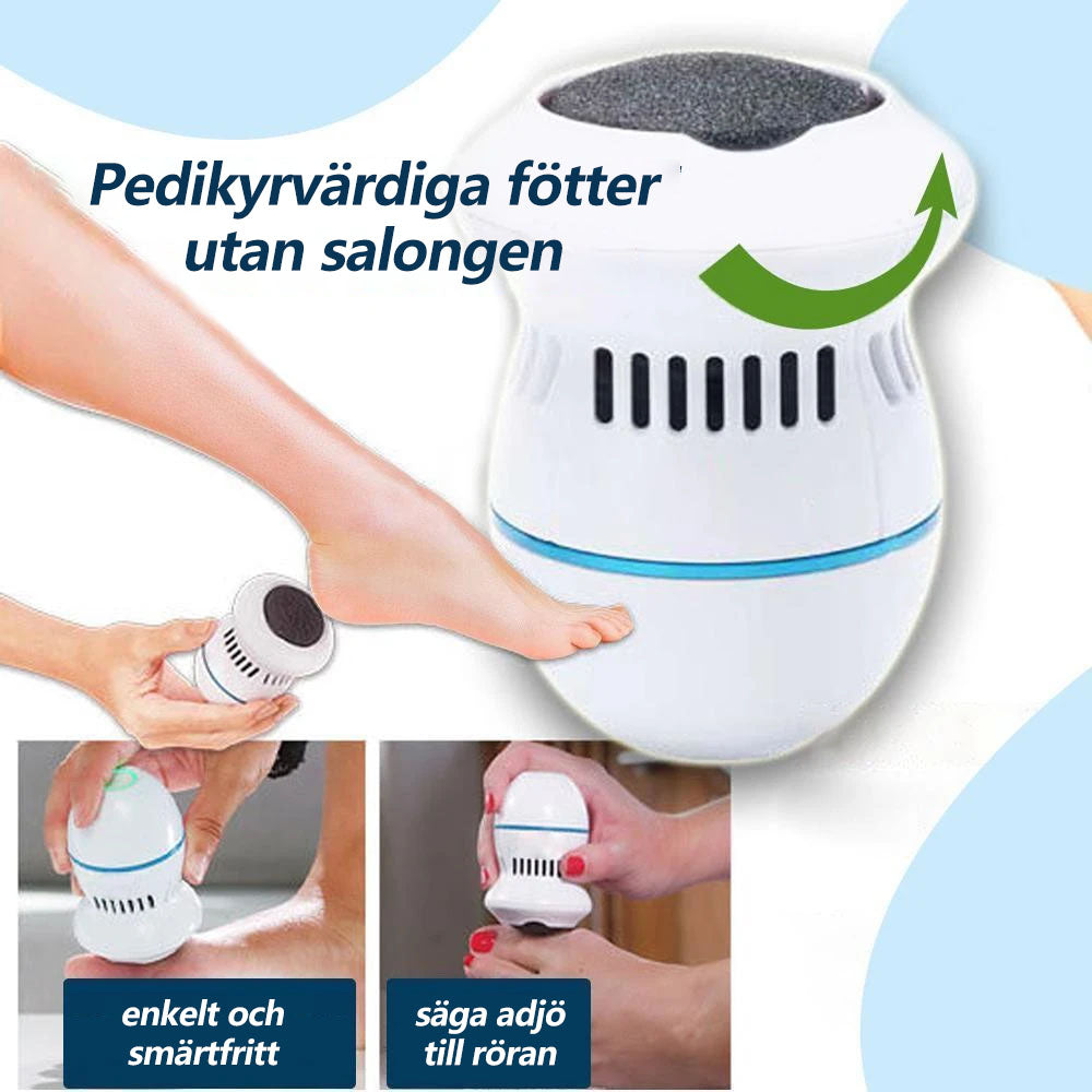 Maliben SoleSmooth Electric Callus Remover — Smooth Feet Fast