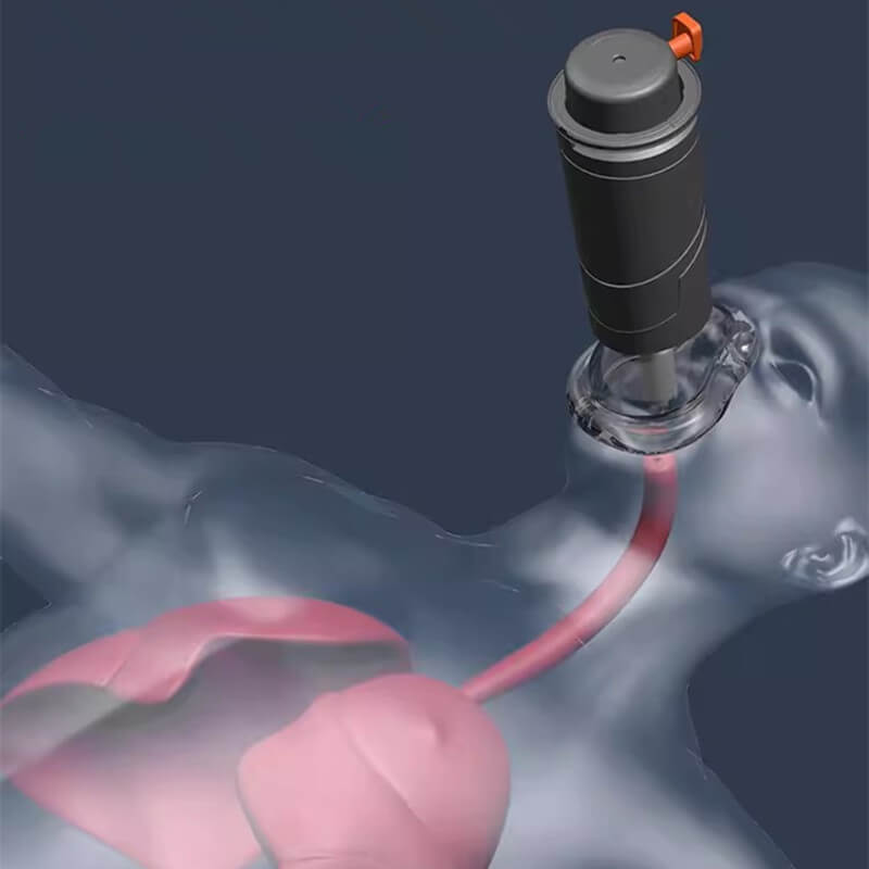 Maliben | Automatic Choking Rescue Device