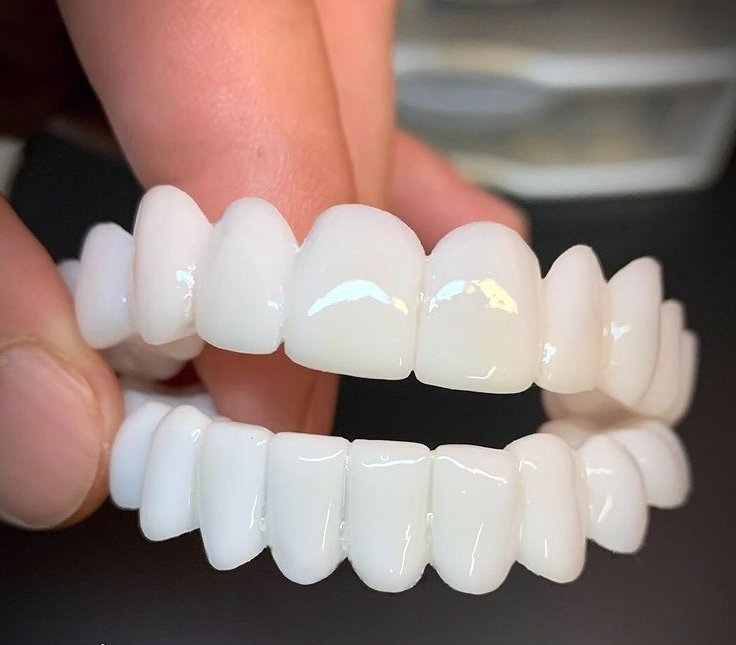Maliben DentAlign Dental Veneers — Natural-Look Tooth Cover