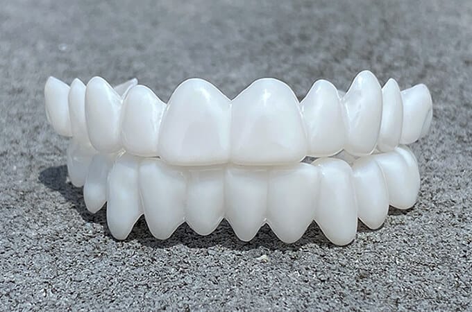 Maliben DentAlign Dental Veneers — Natural-Look Tooth Cover