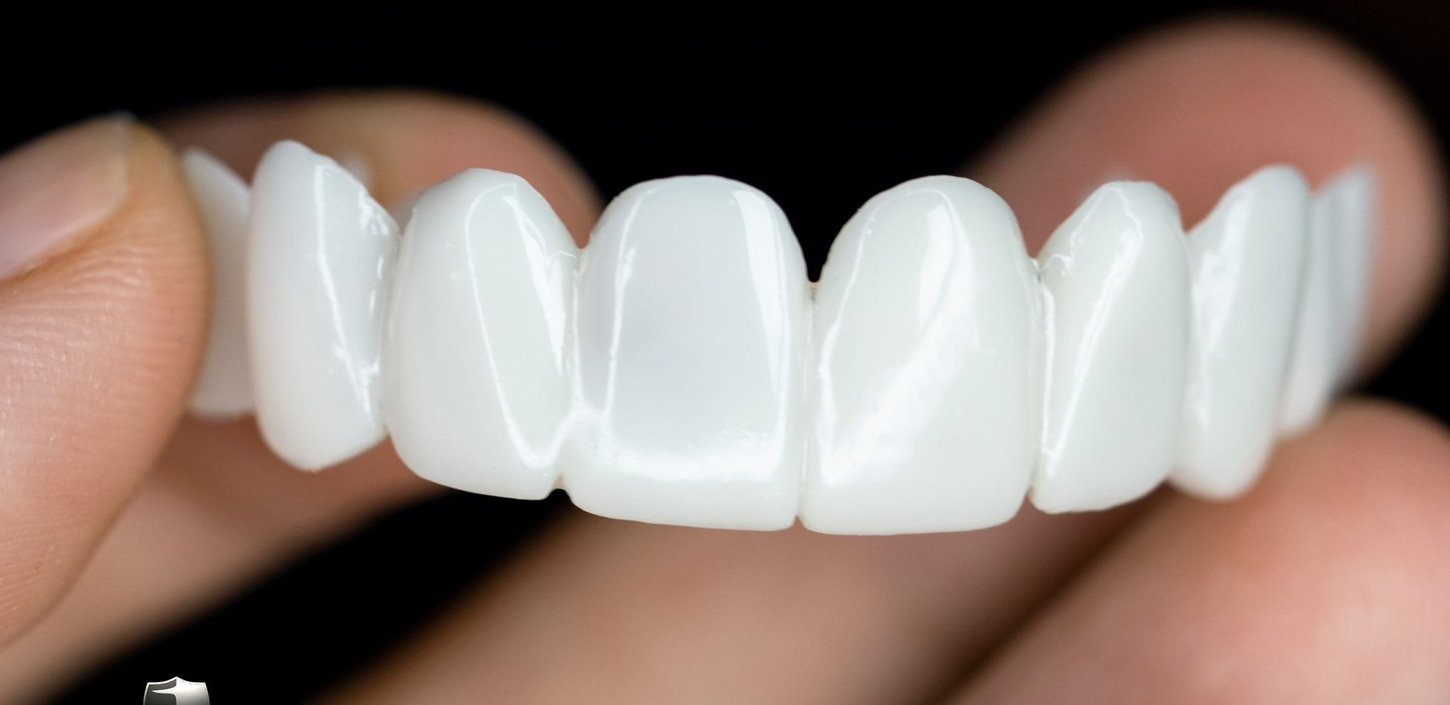 Maliben DentAlign Dental Veneers — Natural-Look Tooth Cover