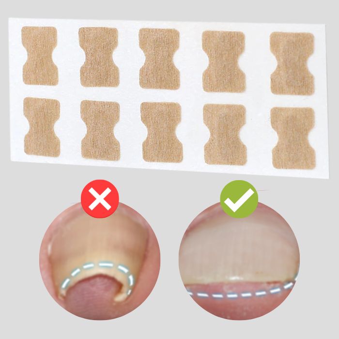 Maliben | Proflexipatches — Pain-Free Natural Nails That You Show Off Again With Pride