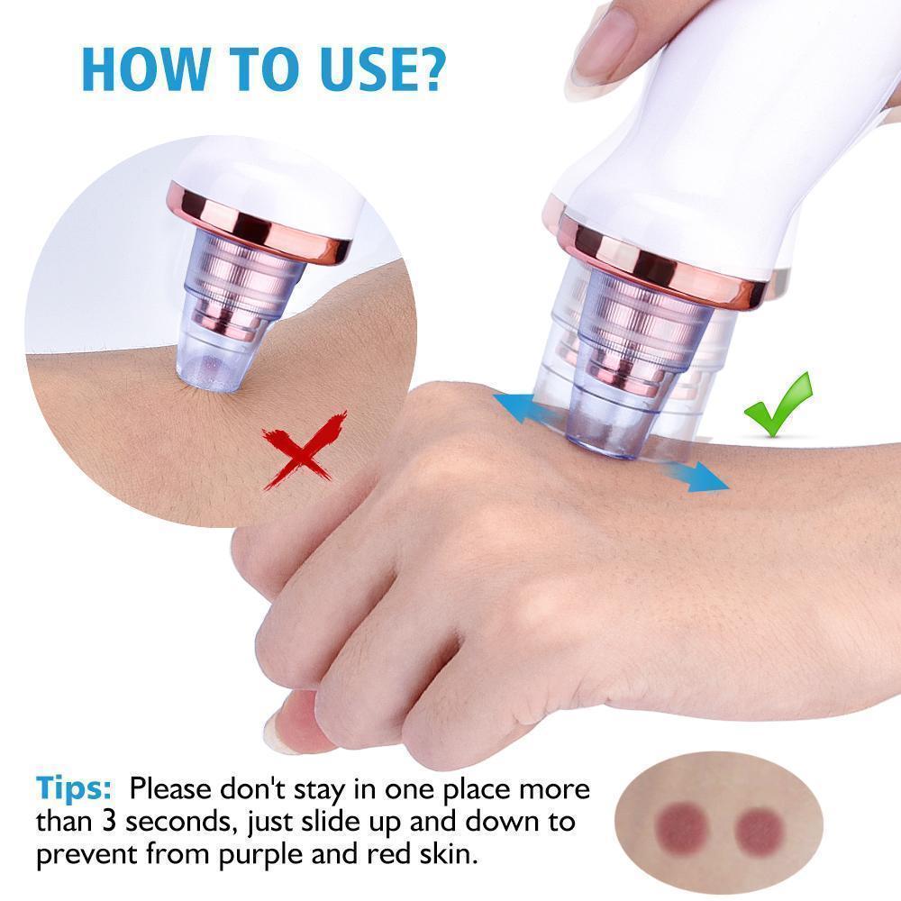 Maliben | Power Suction Blackhead Cleaner