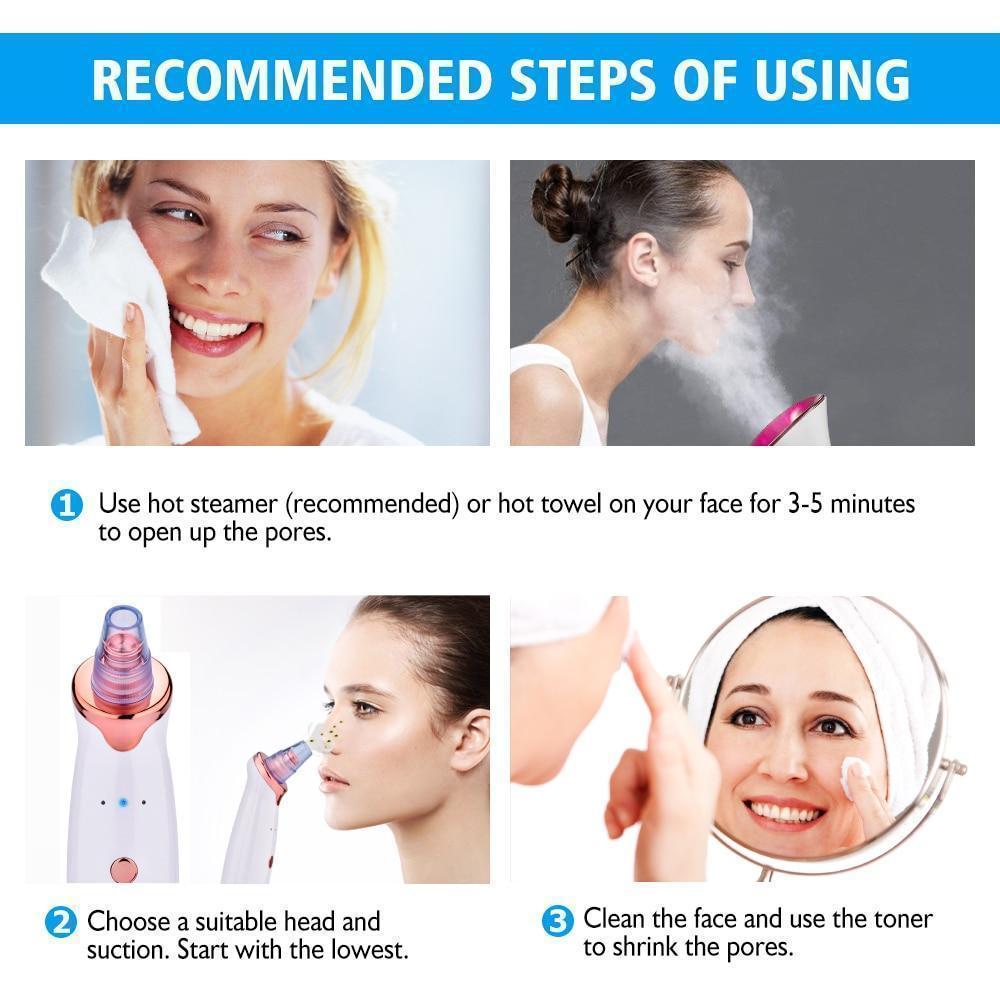 Maliben | Power Suction Blackhead Cleaner