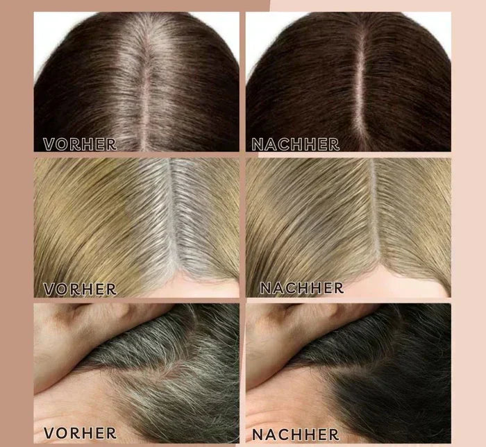 Maliben | Hairhalo – Perfect Hairlines Anytime