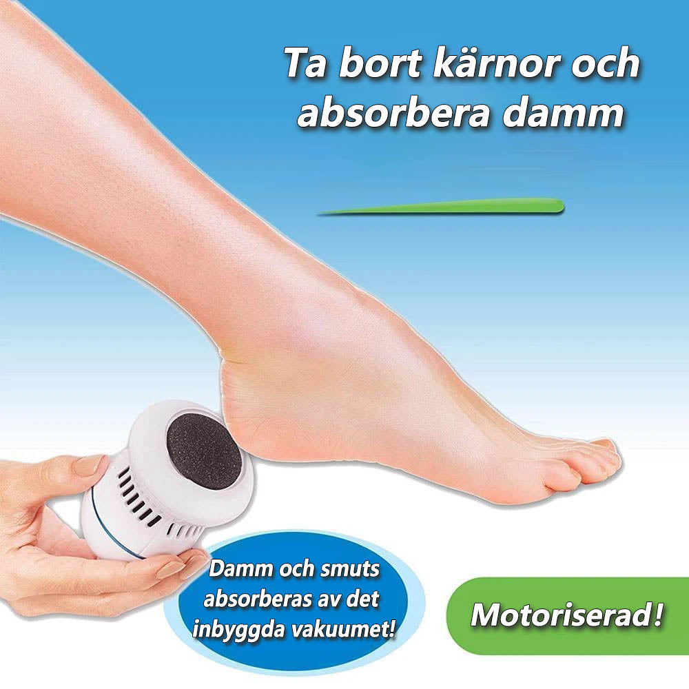 Maliben SoleSmooth Electric Callus Remover — Smooth Feet Fast