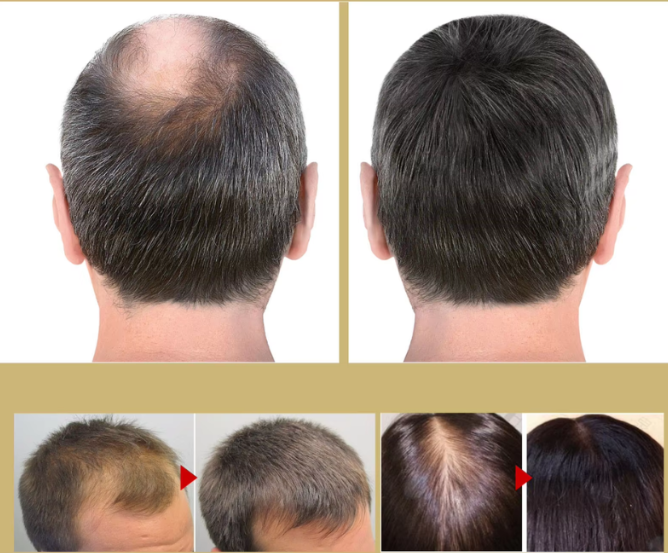 Maliben | VitastrAnd – Experience Thicker, Stronger, and Healthier Hair Every Morning