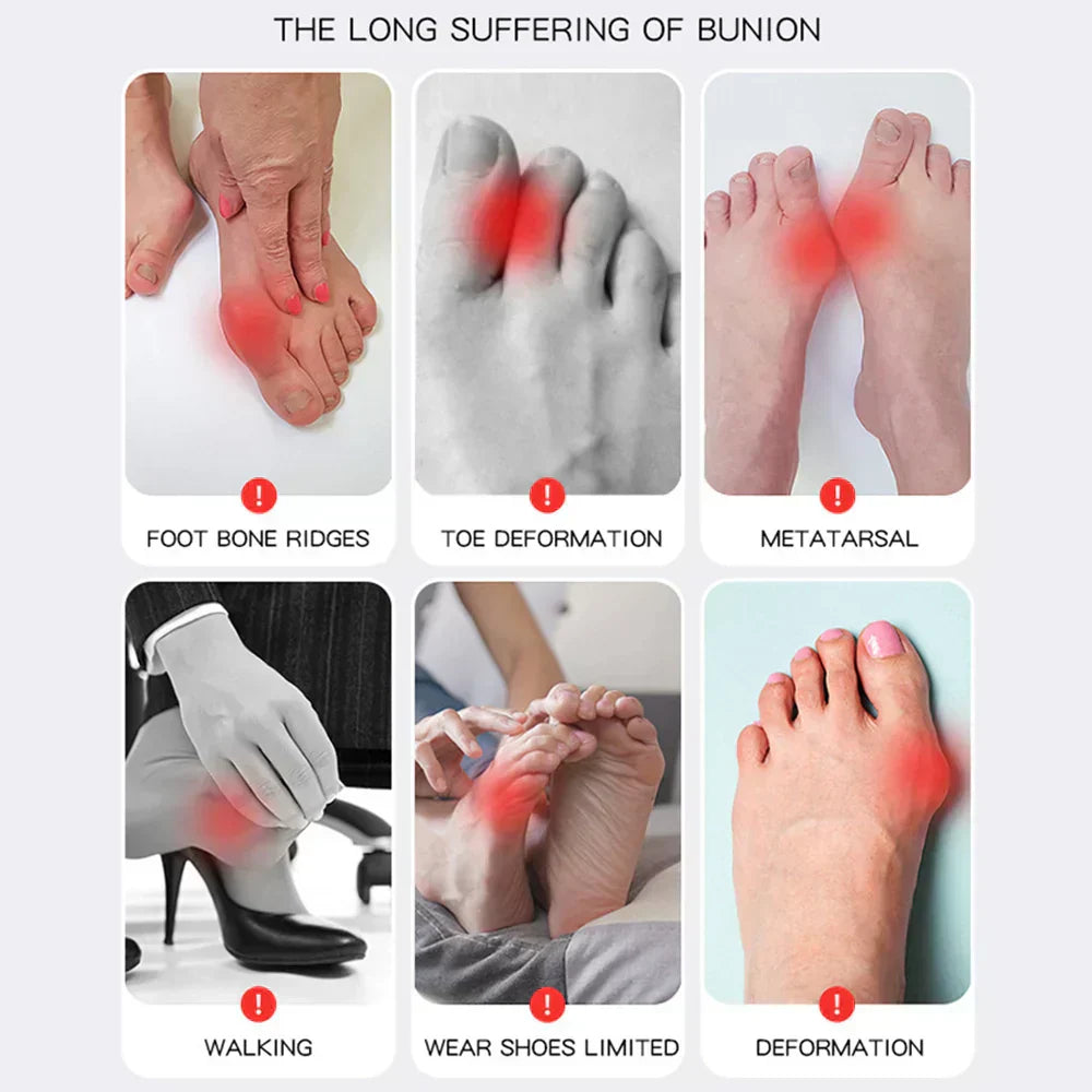 Maliben OrthoFlex Bunion Corrector — Hallux Valgus Relief Brace