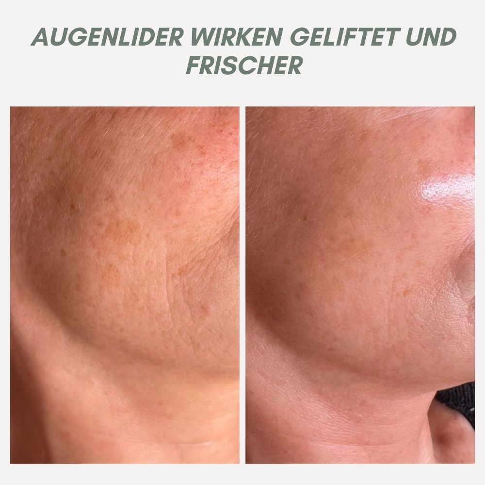 Maliben | Youthmorph — Tight SkIn in Minutes For Your Youthful Wow Moment