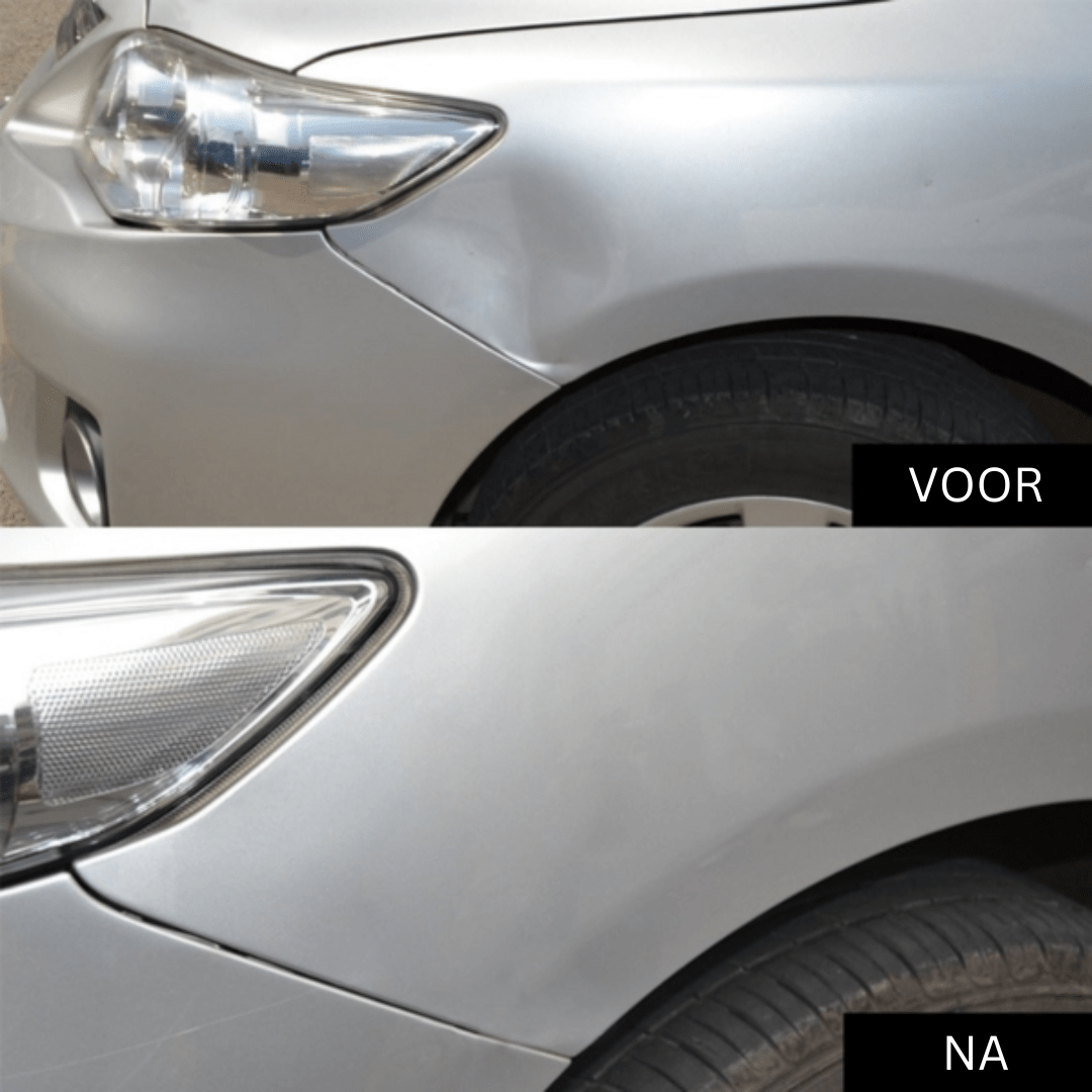 Maliben Fixdent Car Dent Repair Kit — Paintless Dent Remover