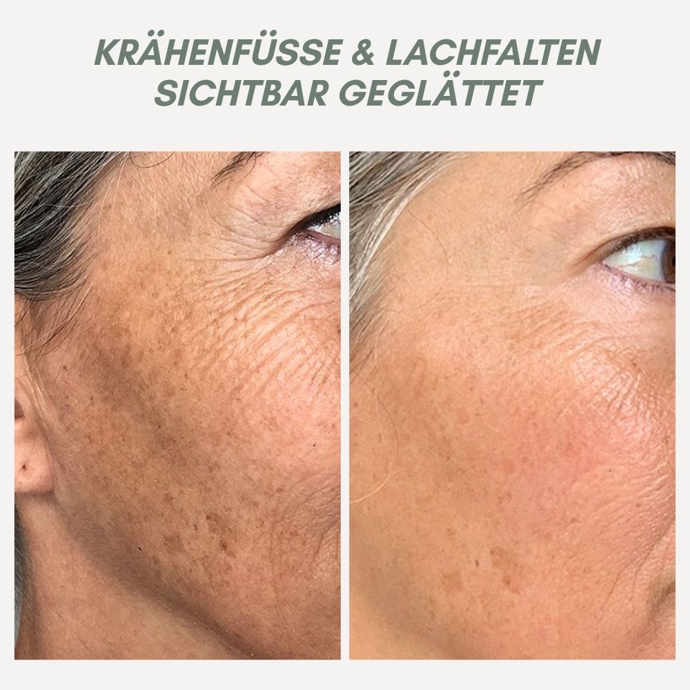 Maliben | Youthmorph — Tight SkIn in Minutes For Your Youthful Wow Moment