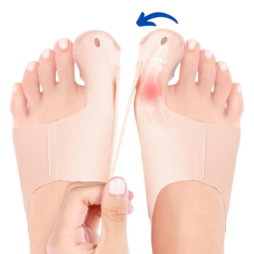 Maliben OrthoFlex Bunion Corrector — Hallux Valgus Relief Brace