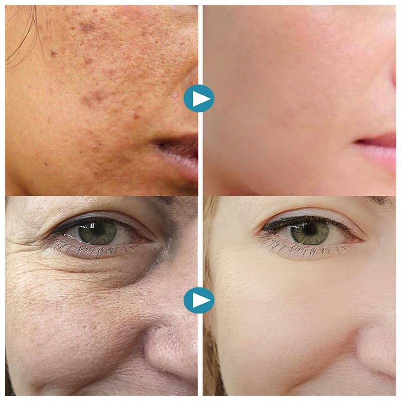Maliben | Silkpores | Smooth And Radiant Skin