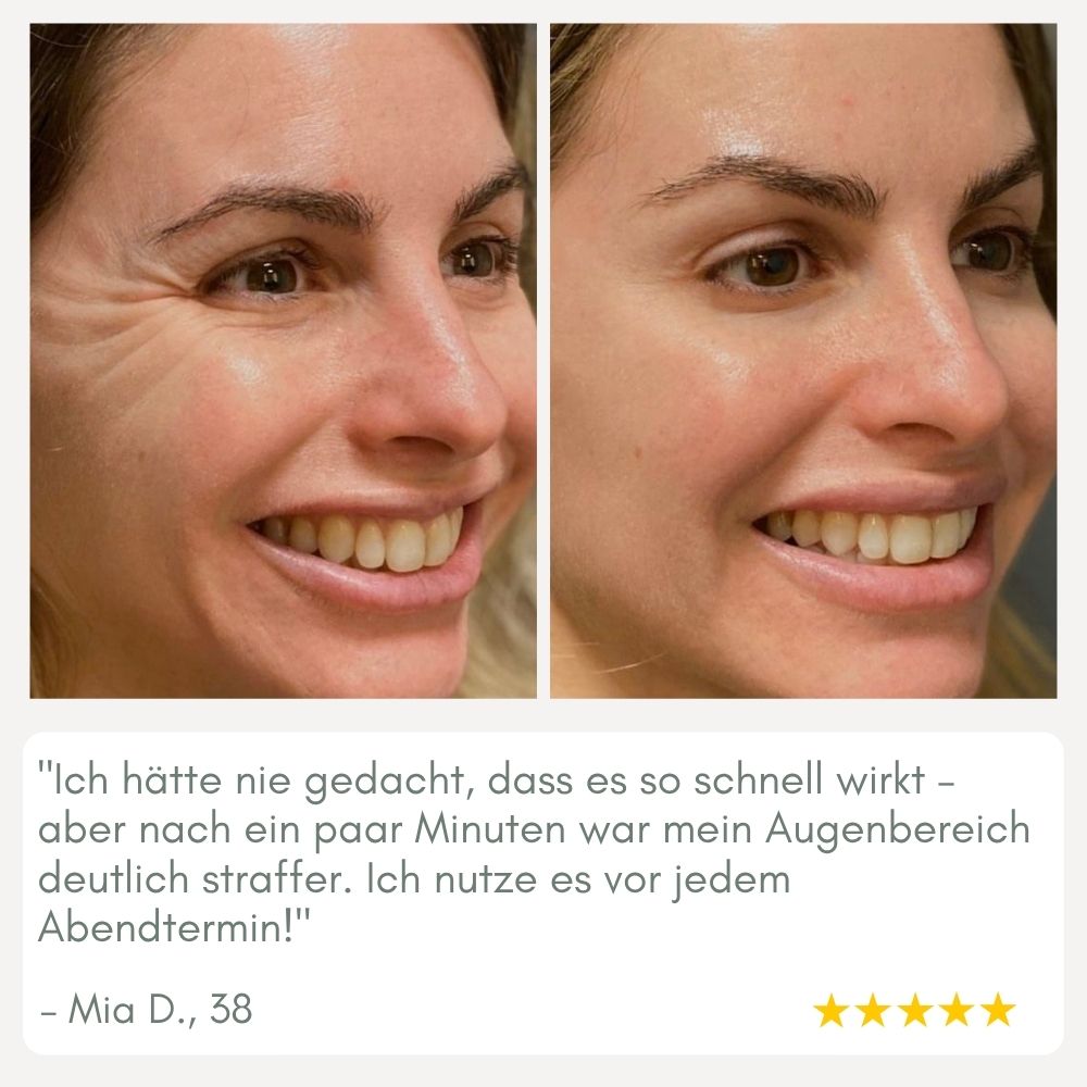 Maliben | Youthmorph — Tight SkIn in Minutes For Your Youthful Wow Moment