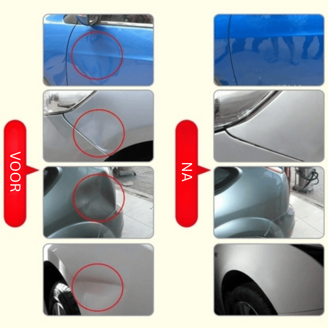 Maliben Fixdent Car Dent Repair Kit — Paintless Dent Remover