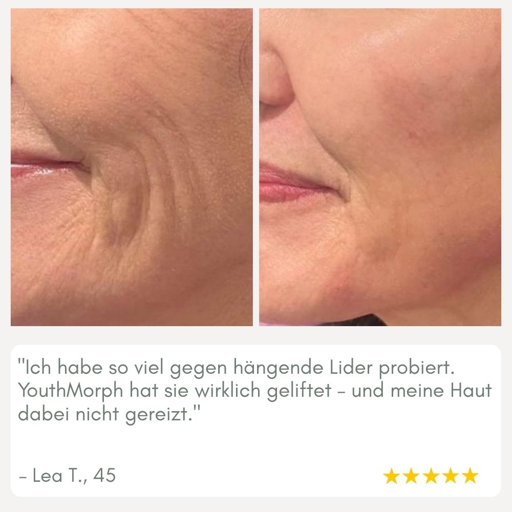 Maliben | Youthmorph — Tight SkIn in Minutes For Your Youthful Wow Moment