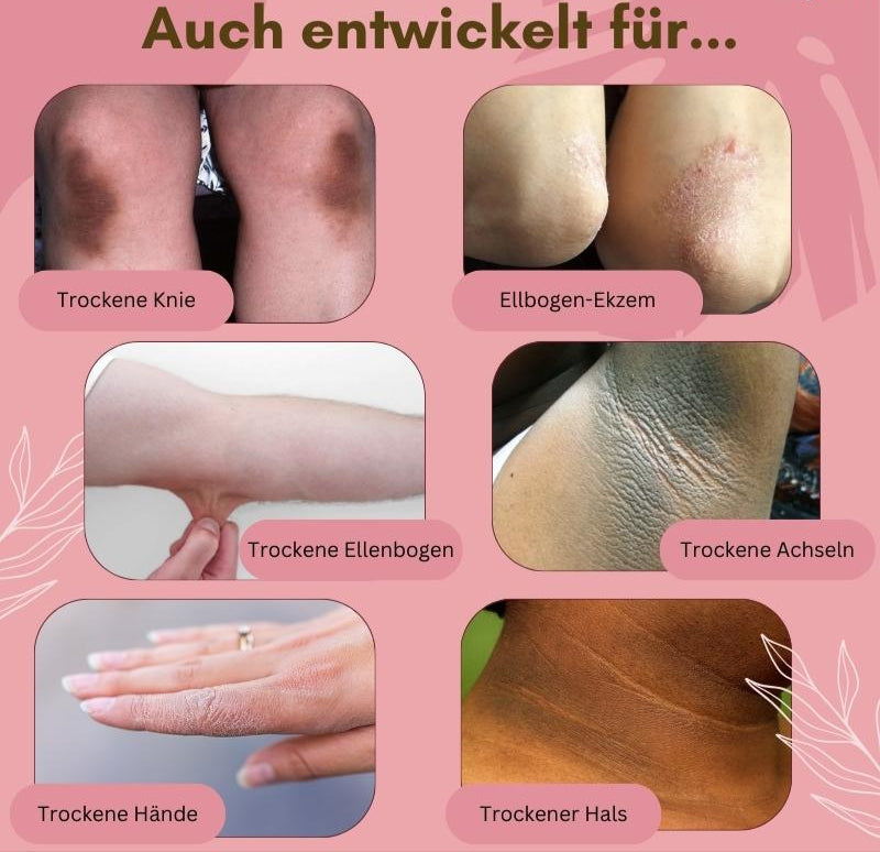 Maliben | Dermashield — Quick Relief For Cracked, Itchy Feet That Want To Breathe Freely