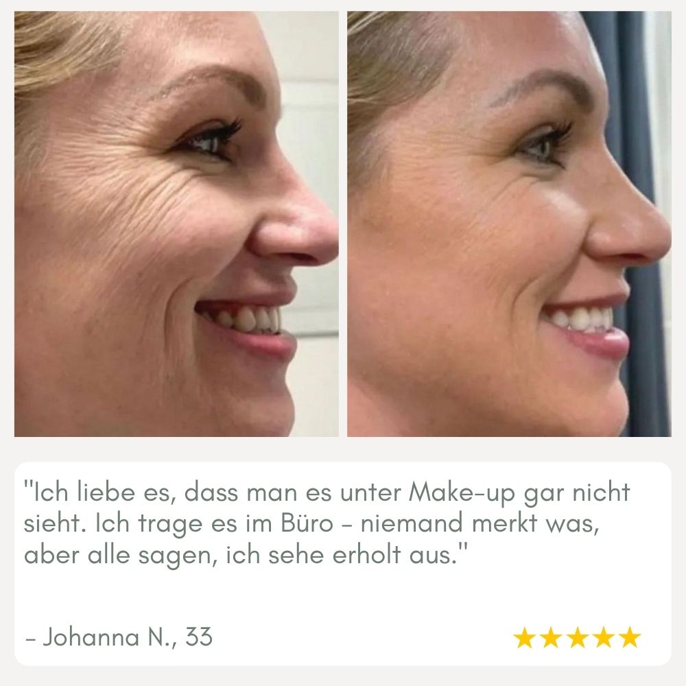 Maliben | Youthmorph — Tight SkIn in Minutes For Your Youthful Wow Moment