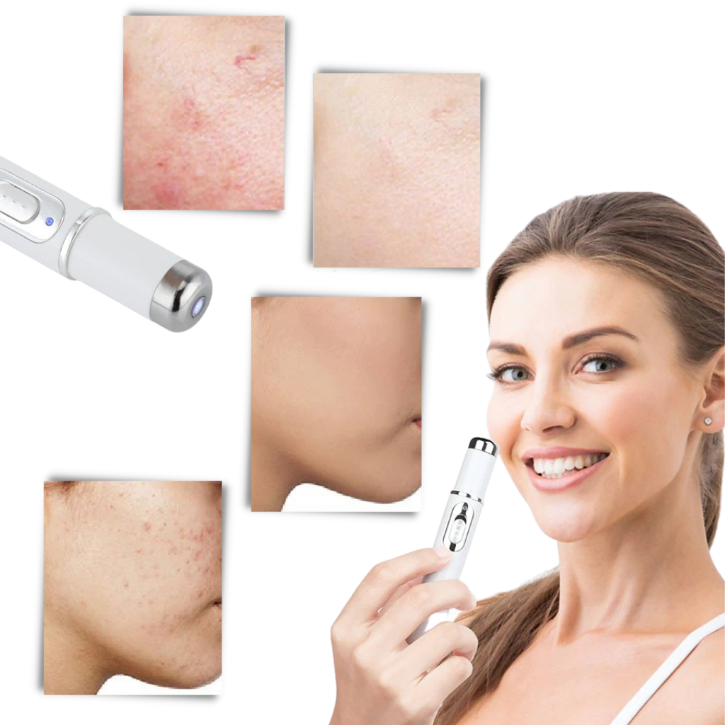 Maliben | Blue Light Skin Therapy Pen