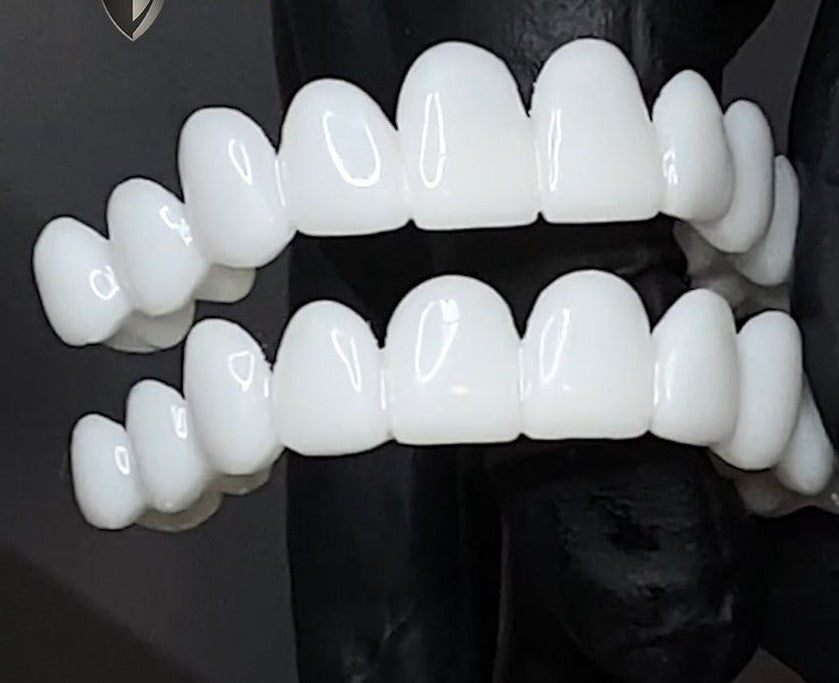 Maliben DentAlign Dental Veneers — Natural-Look Tooth Cover