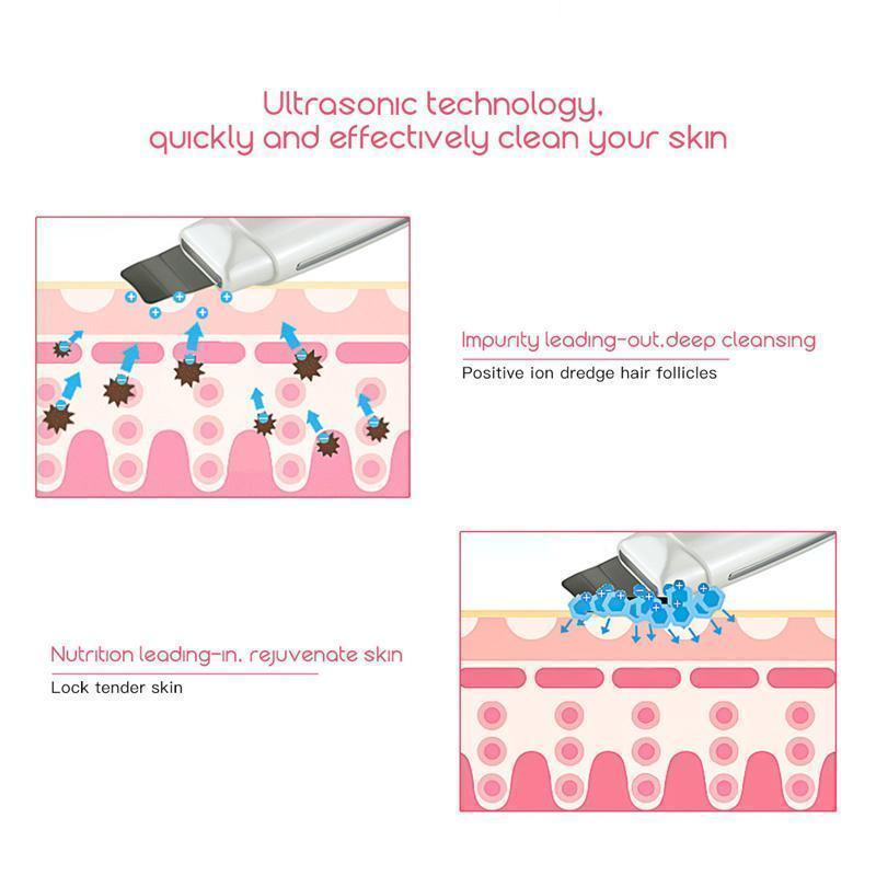 Maliben | Deep Cleansing Ultrasonic Skin Revitalizer