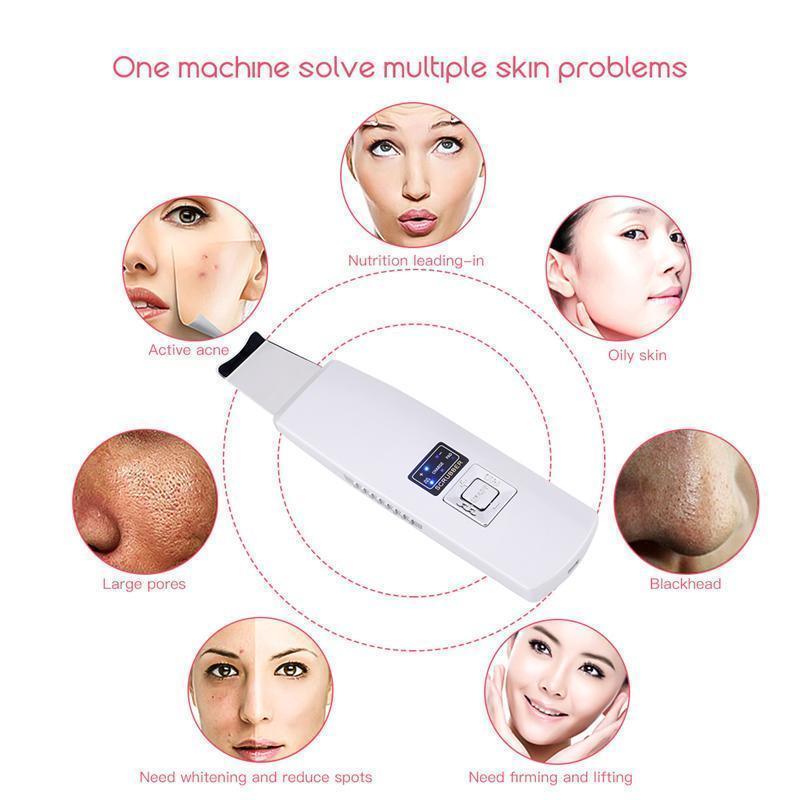 Maliben | Deep Cleansing Ultrasonic Skin Revitalizer
